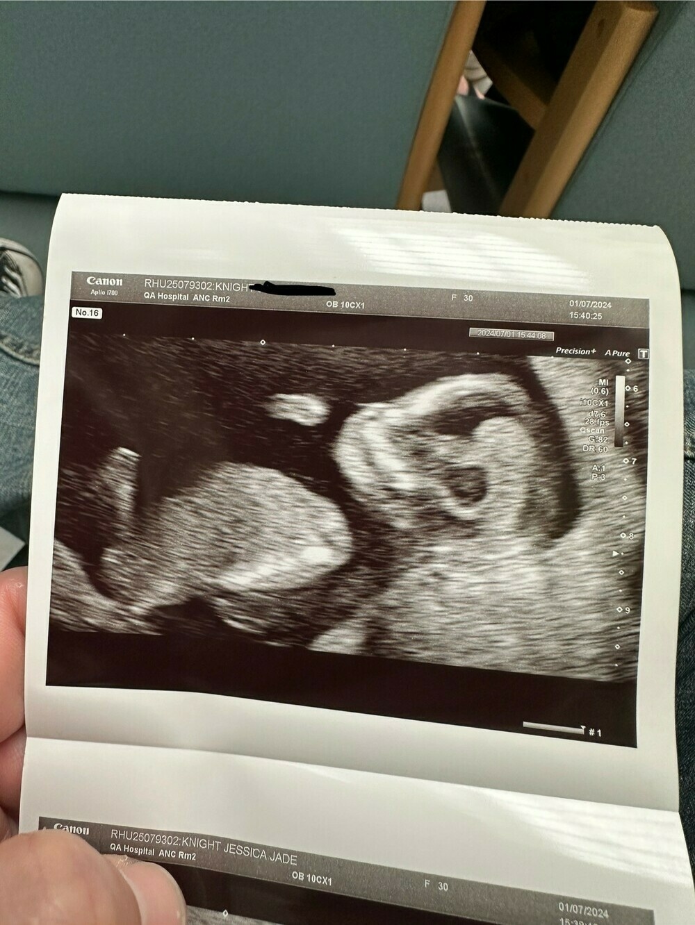 A scan of a baby 