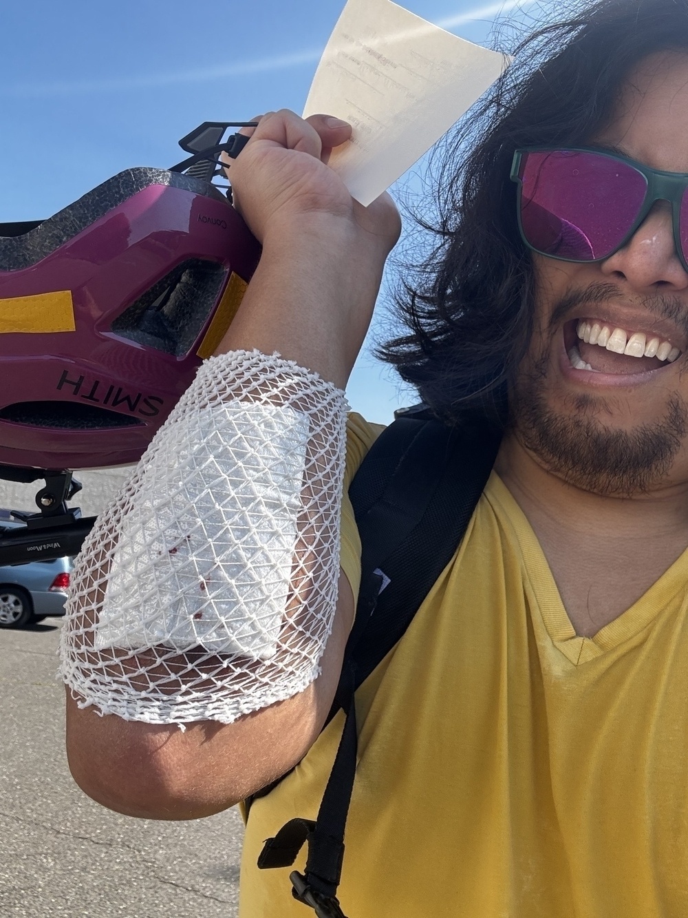 A person in a yellow shirt and green-tinted sunglasses is holding up a purple helmet in one hand and a piece of paper in the other. Their right elbow is bandaged with a white gauze pad under a mesh covering. They are smiling widely, and the sky is clear and blue in the background.